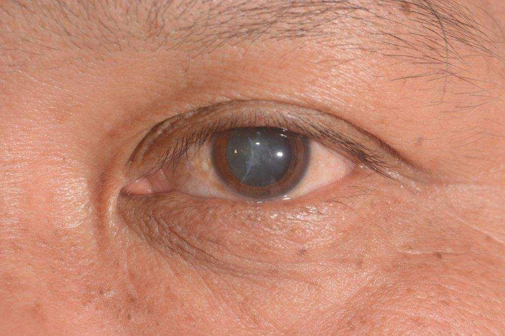 ""